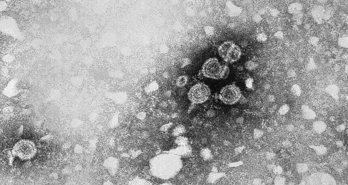 Hepatitis B